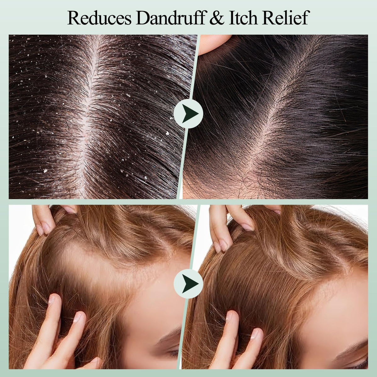 VOERUY being applied to wet hair at roots to lift buildup and prepare scalp for rinse