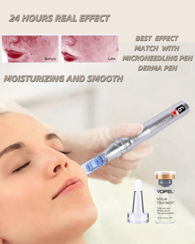VOFEL dropper dispensing serum demonstrating controlled application for treatments