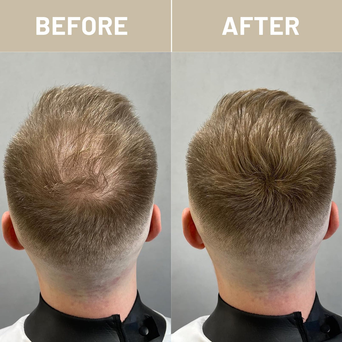 VOLLUCK before and after top view showing visible reduction in thinning appearance