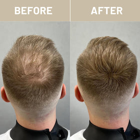 VOLLUCK before and after top view showing visible reduction in thinning appearance