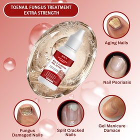 Voltixyn nail file and applicator included for precise application benefit
