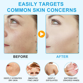 Vortexonix ingredient label close-up confirming pure hyaluronic acid content