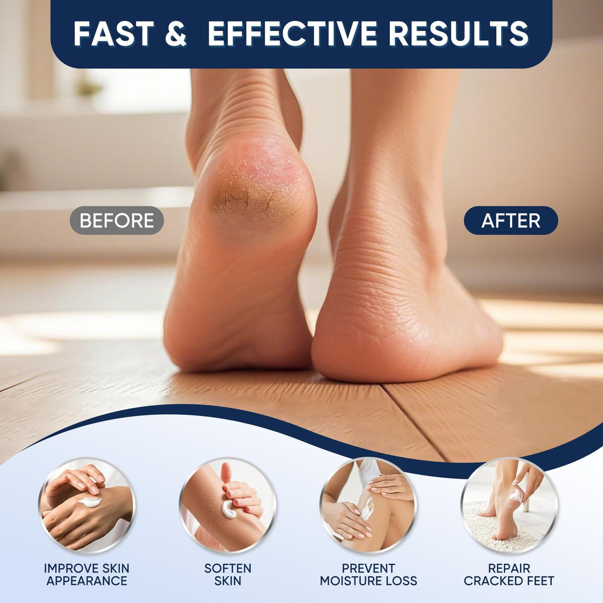 VREKEF being applied to heel to soften callus and hydrate dry skin
