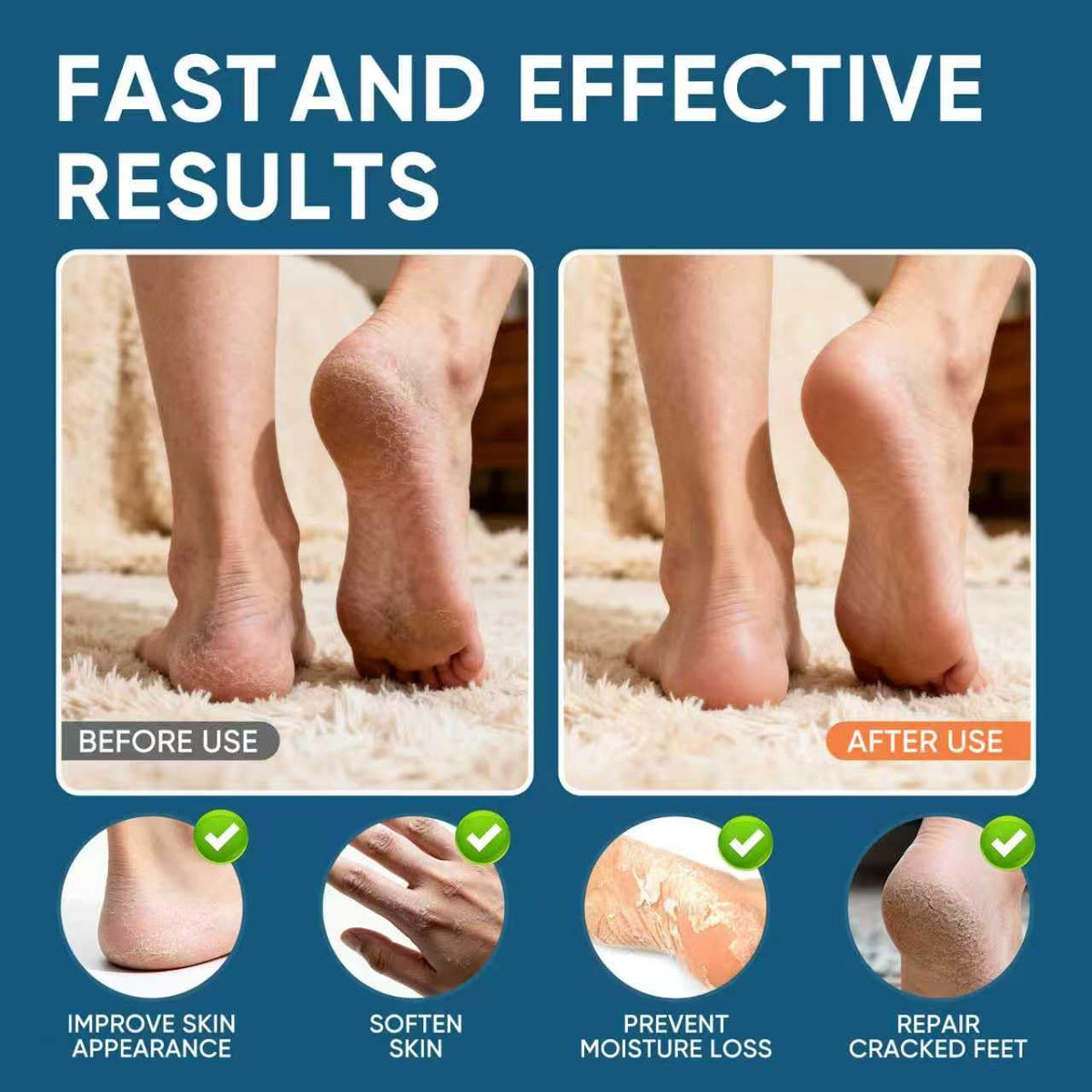VREKEF application on heel demonstrating callus softening benefit