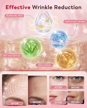 Vryioh forehead patch placement illustrating targeted wrinkle care
