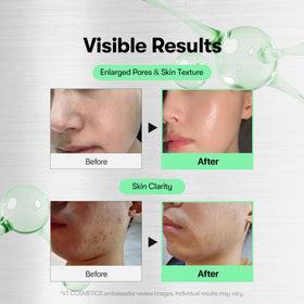 VT COSMETICS dropper dispensing Reedle Shot serum for precise application and absorption