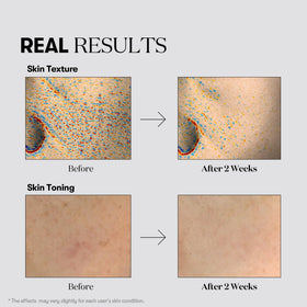 VT COSMETICS mask applied on model demonstrating brightening effect