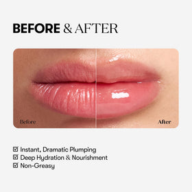 VT COSMETICS Reedle Shot on lips model demonstrating glossy fuller look