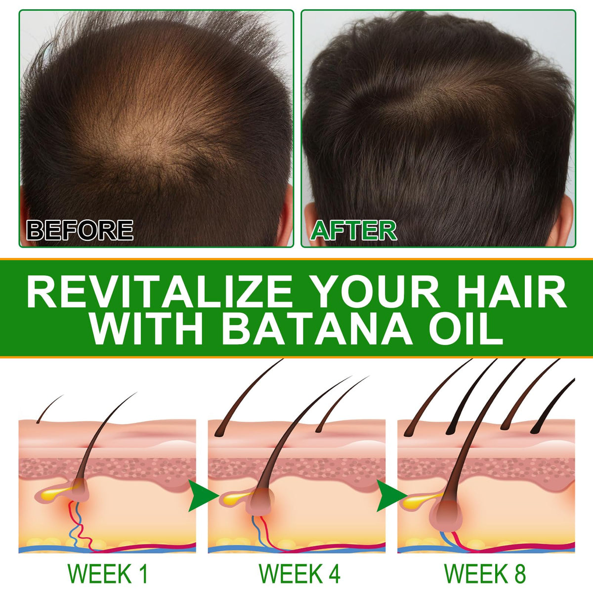 VXHDAG applying Batana oil to scalp using fingers for nourishment