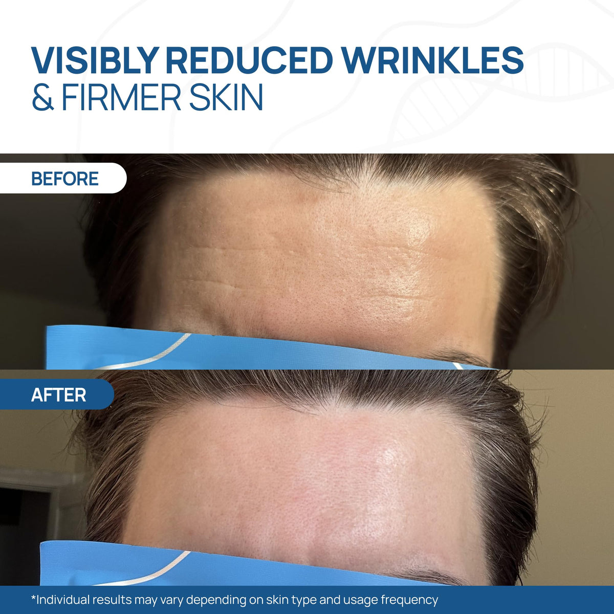 Mask turning transparent on skin indicating Welaroise full absorption