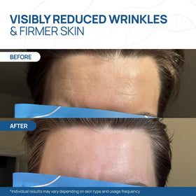 Mask turning transparent on skin indicating Welaroise full absorption