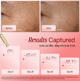 WELL FOUNTAIN applying serum to face and neck to enhance red light results