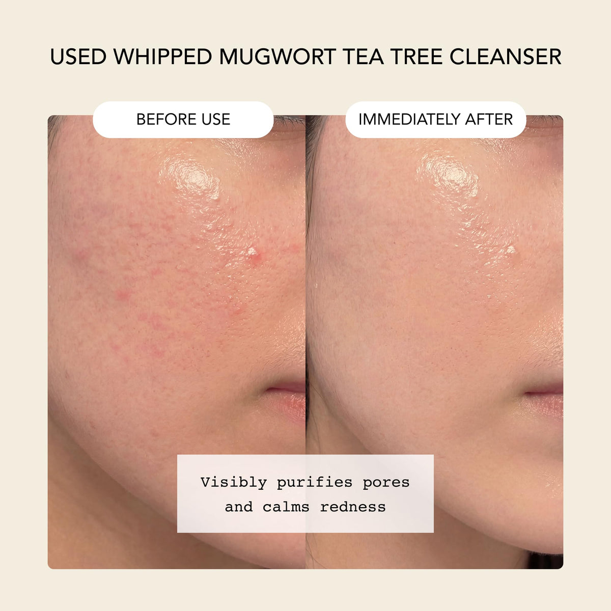 Whipped Semo Company mugwort detail showing botanical calming benefit