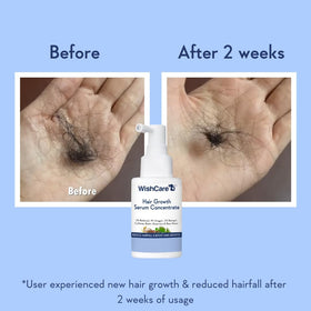 WishCare micro-spray applied to scalp demonstrating targeted application benefit