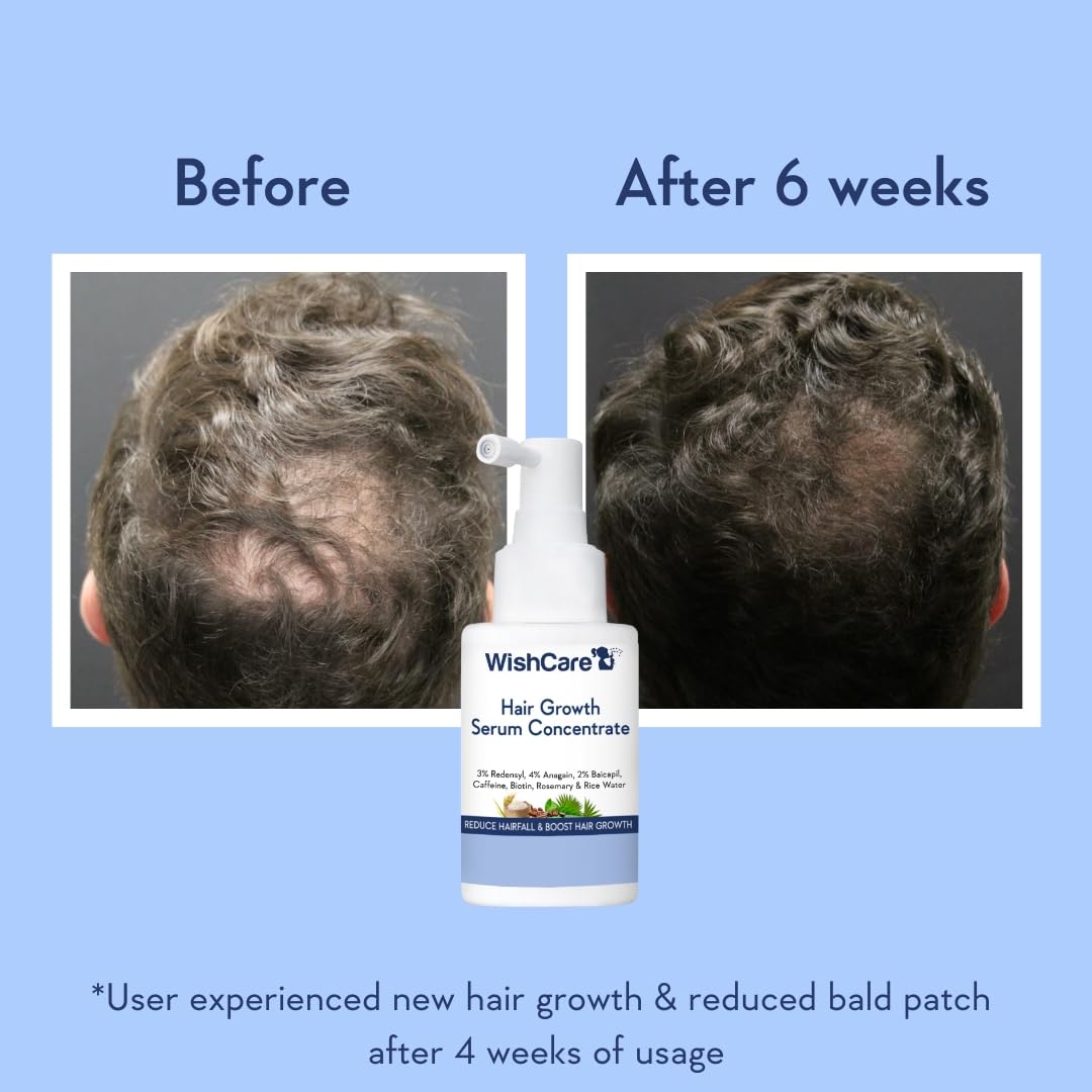 WishCare illustrative before and after scale showing improved hair density appearance