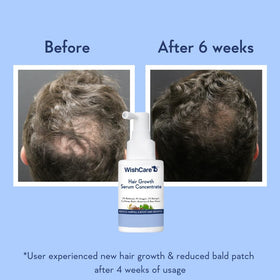 WishCare illustrative before and after scale showing improved hair density appearance