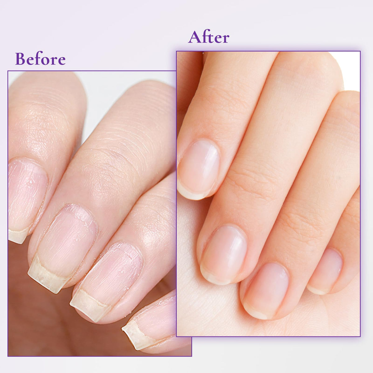 WM WONDER MOJO applied after a manicure to calm skin and improve appearance
