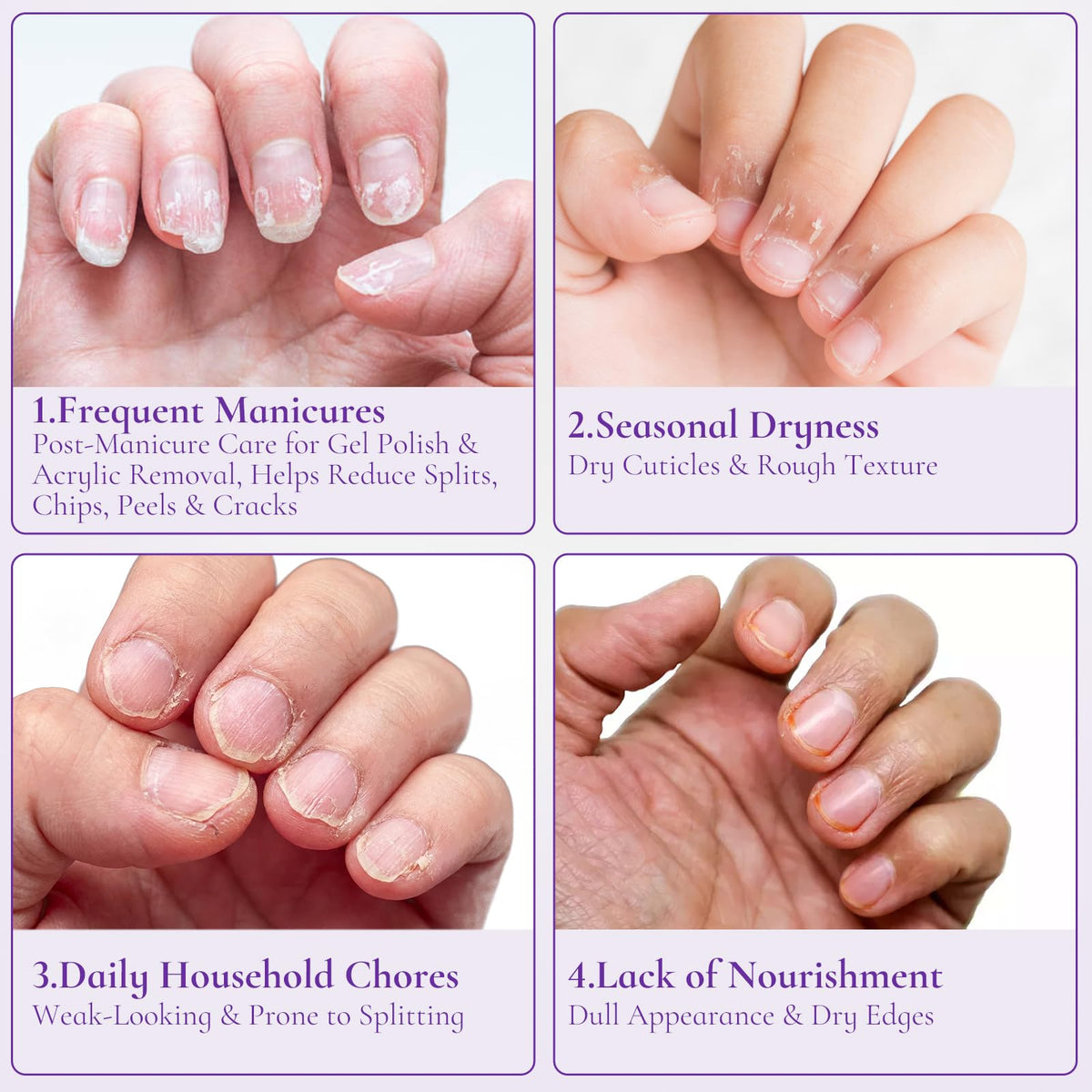 WM WONDER MOJO being massaged into a cuticle to soothe and soften skin