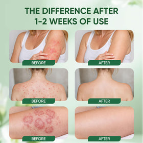 WNOHIQ Healora application under breast illustrating reduced rubbing and breathable barrier benefit