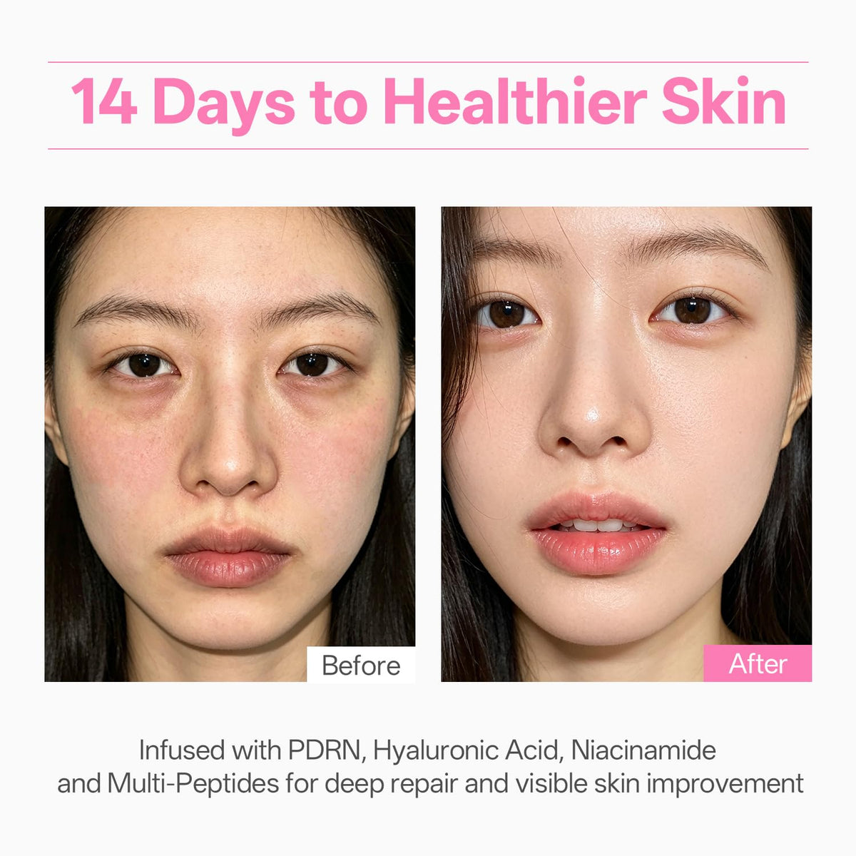 WNP cream applied on cheek demonstrating immediate dewy luminous effect