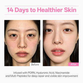 WNP cream applied on cheek demonstrating immediate dewy luminous effect