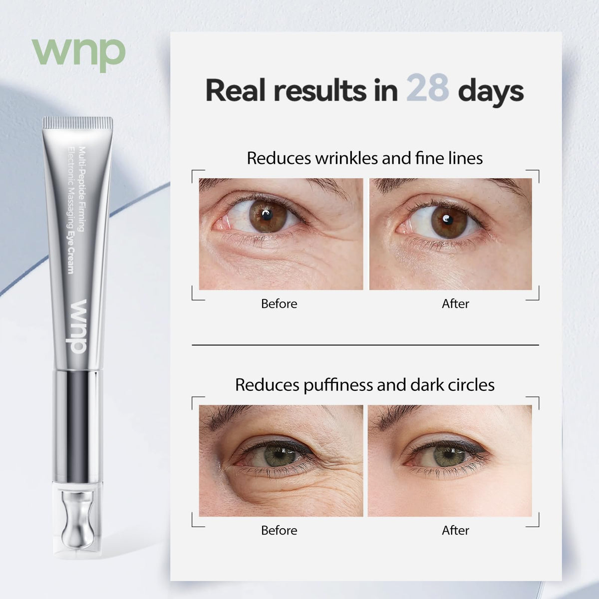 WNP before and after illustration, shows reduced puffiness effect