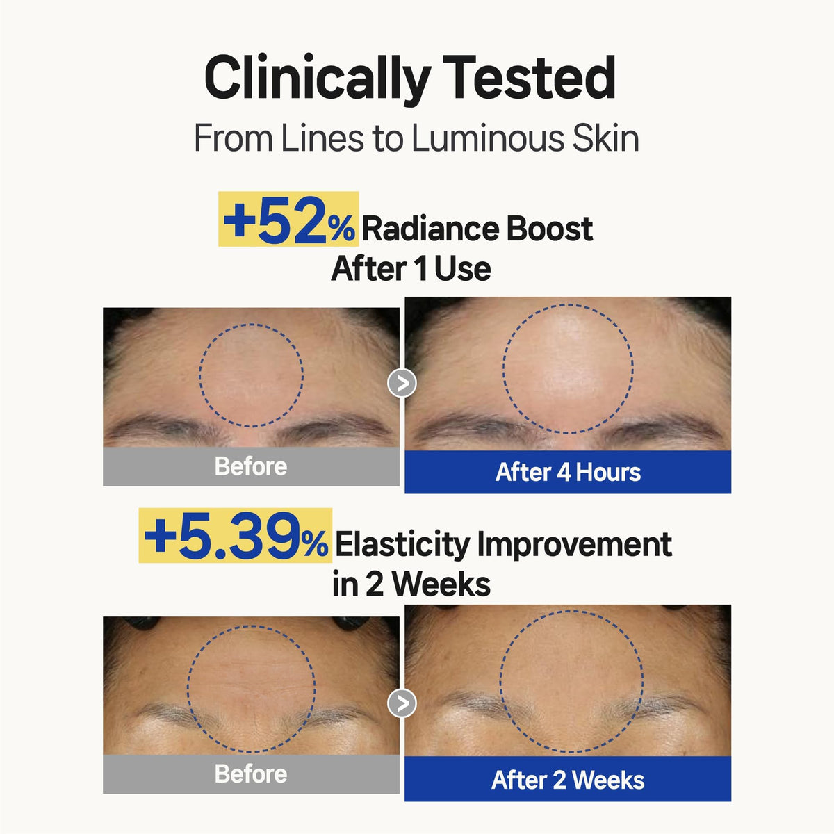 Wooshin Labottach patch applied to forehead for overnight smoothing