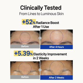 Wooshin Labottach patch applied to forehead for overnight smoothing