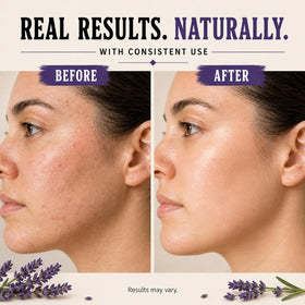 Wrath & Remedy balm on fingertips demonstrating easy warm-and-apply benefit