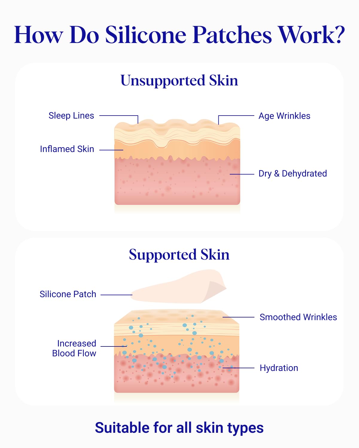 Wrinkles Schminkles patch fitted in cleavage highlighting wrinkle prevention benefit