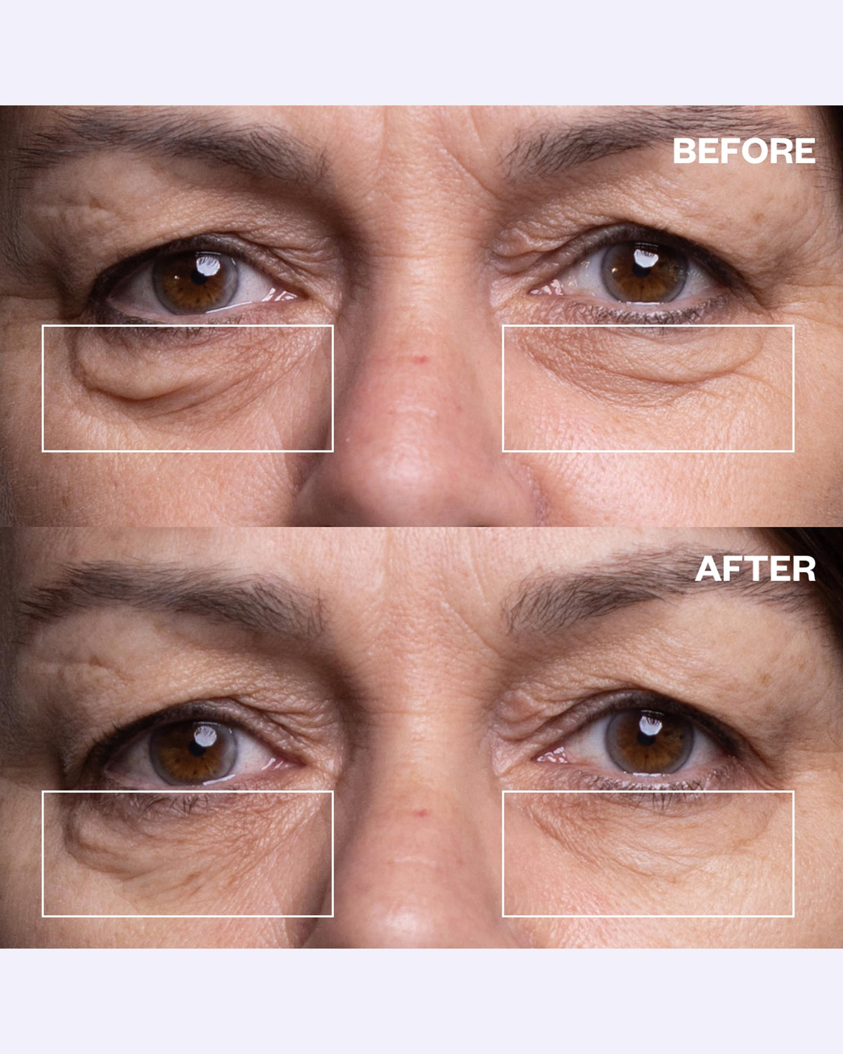 Wrinkles Schminkles pair applied on under-eye demonstrating smoothing effect