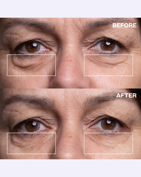 Wrinkles Schminkles pair applied on under-eye demonstrating smoothing effect