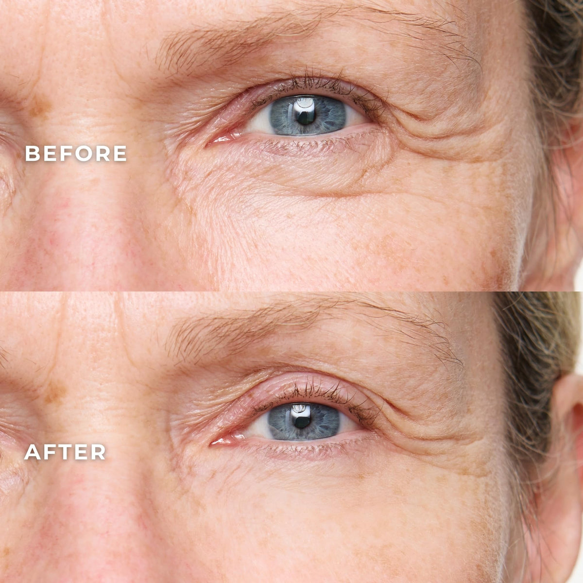 WUNDER2 applicator close-up highlighting precise under-eye delivery