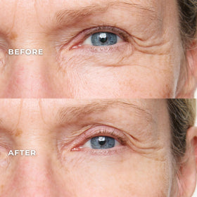 WUNDER2 applicator close-up highlighting precise under-eye delivery