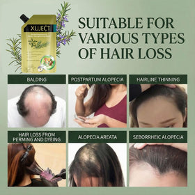 XUJECT before-and-after hair visual showing fuller looking results