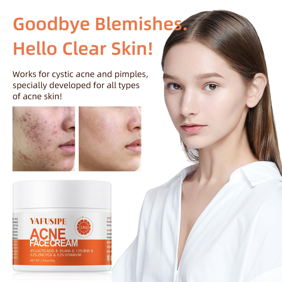 YAFUSIPE applying cream to facial spot demonstrating fast-acting blemish relief