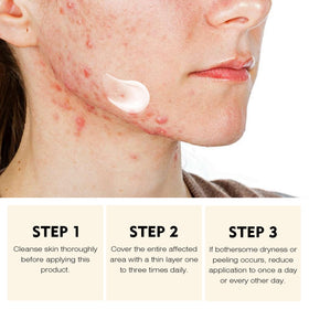 YAFUSIPE treating back acne area showing body-safe application advantage
