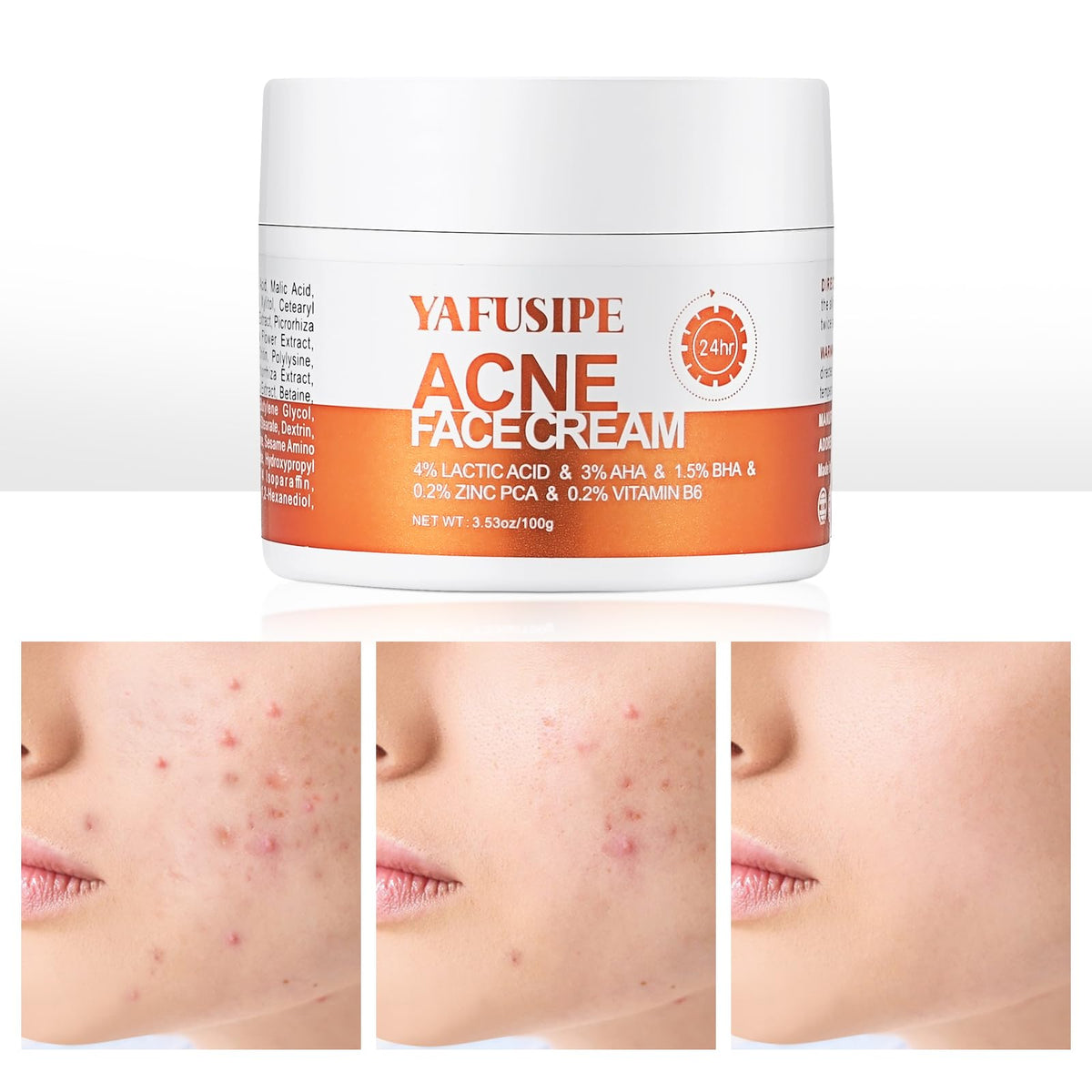 YAFUSIPE jar front view showing product and clear branding for targeted acne care