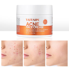 YAFUSIPE jar front view showing product and clear branding for targeted acne care