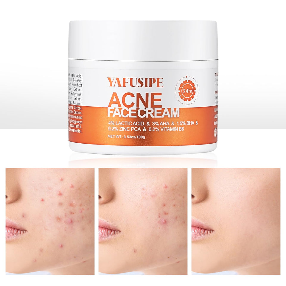 YAFUSIPE jar front view showing product and clear branding for targeted acne care