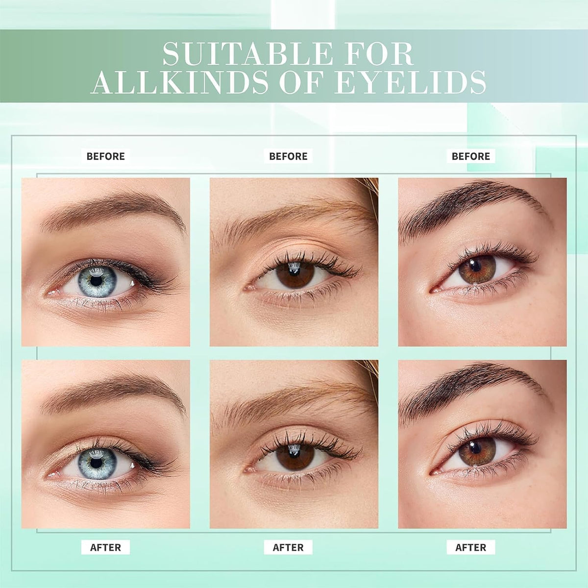 YAGUVI before and after eyes demonstrating natural-looking lift