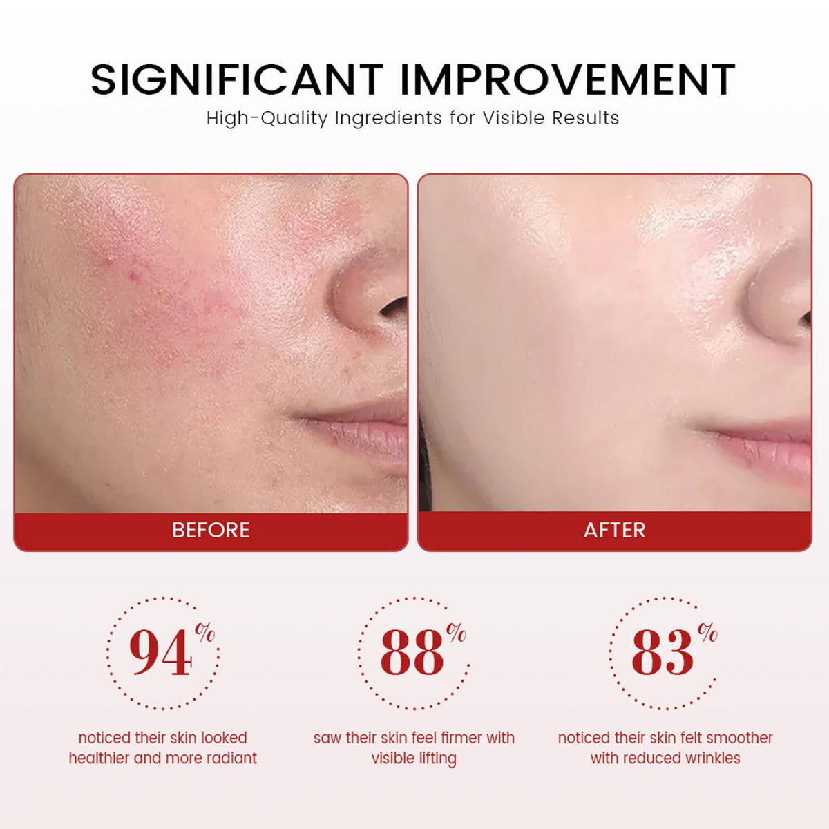 YAKINI Koriderm applied on hand demonstrating smooth spreadability and firming effect