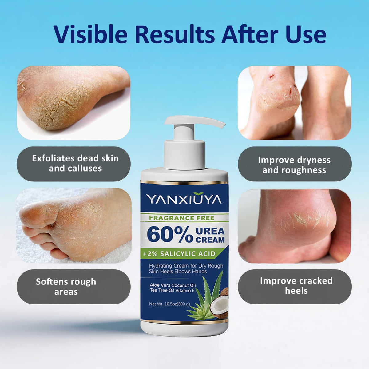 YANXIUYA applied to heel in use to soften cracked skin and calluses