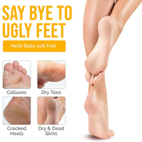 Generic applying peeling oil to foot to soften calluses and dead skin