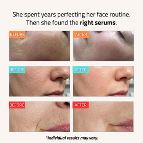 YEOUTH hyaluronic acid serum texture drops providing visible hydration
