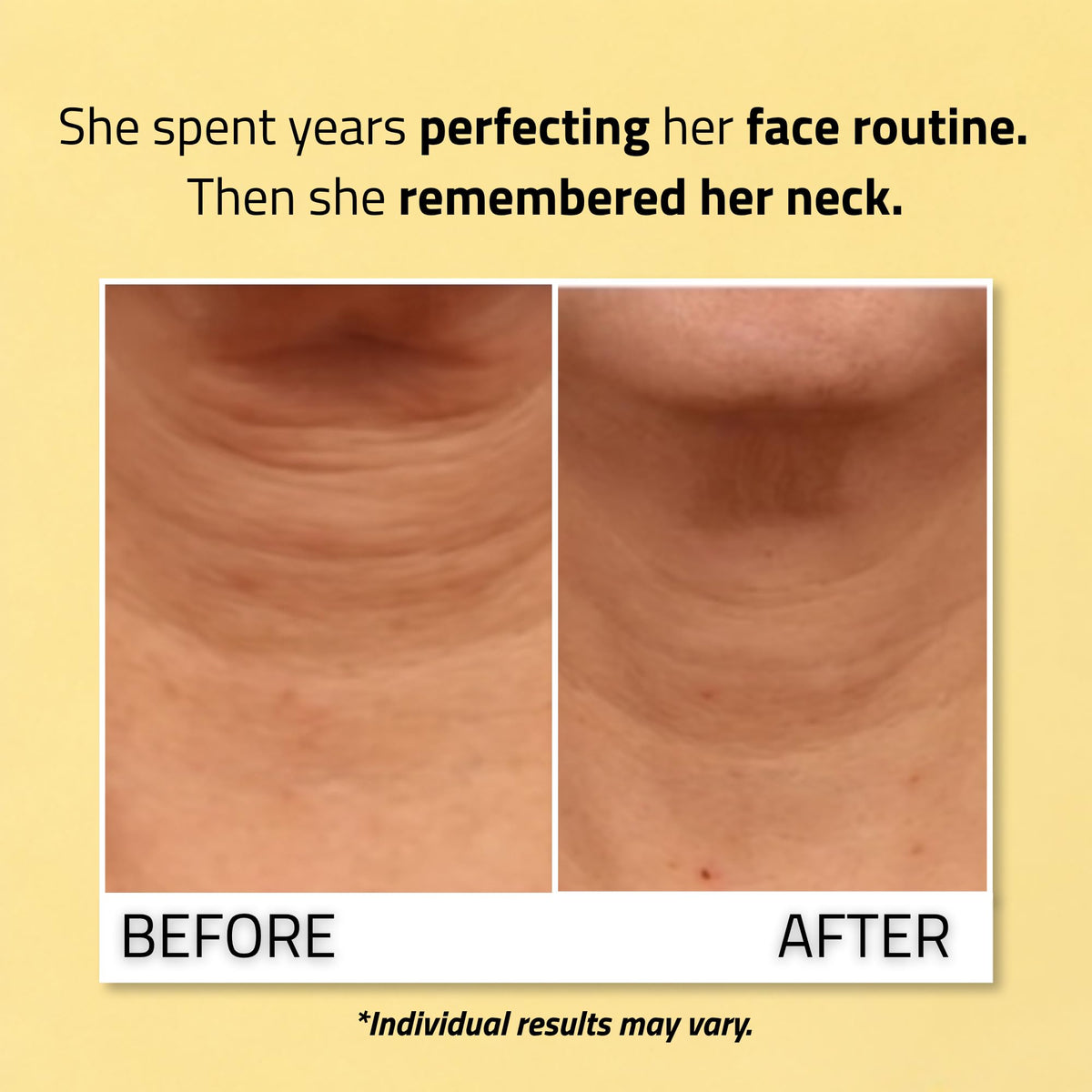 YEOUTH cream spread on décolletage showing smoother skin benefit