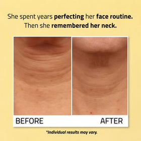 YEOUTH cream spread on décolletage showing smoother skin benefit