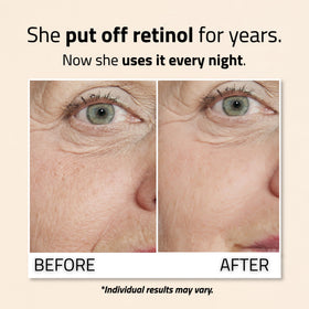 YEOUTH retinol serum bottle in hand for scale, communicates travel-friendly size
