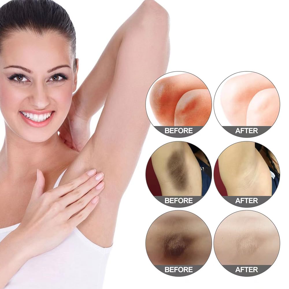 Yeweian elbow and knee treatment example showing improved even tone benefit