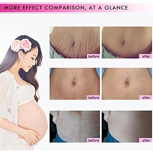 YG LianKai in maternity setting showing gentle care benefit